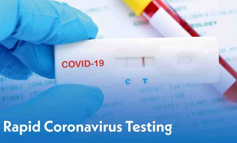 negative RT-PCR test