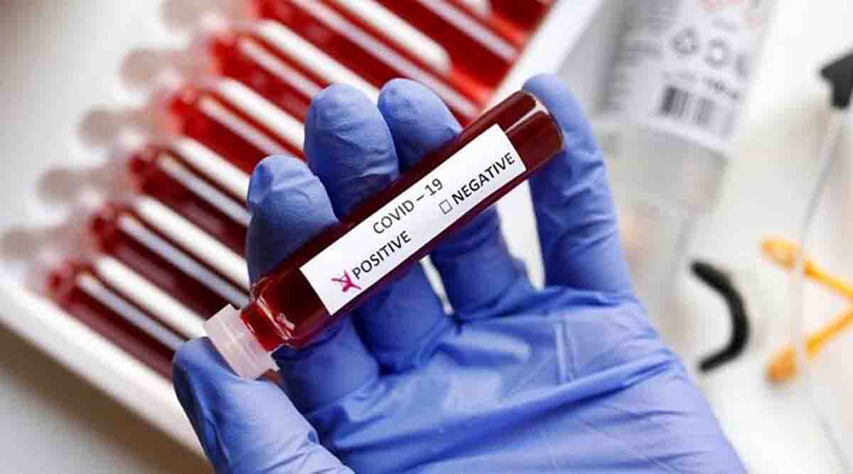 44 new Covid-19 cases reported in U’khand