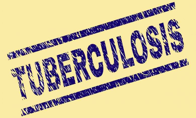 Tuberculosis
