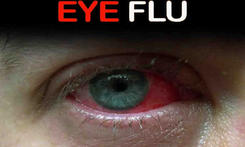 Eye flu